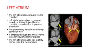 Cardiac anatomy and imaging techniques | PPTX