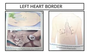 Cardiology examination palpation Presentation (1) 5.pptx