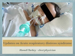 Updates on Acute respiratory distress syndrome
Hamdi Turkey - chest physician
 