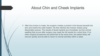 About Chin and Cheek Implants | PPTX