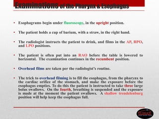 Examinations of the Pharynx & Esophagus
• Esophagrams begin under fluoroscopy, in the upright position.
• The patient holds a cup of barium, with a straw, in the right hand.
• The radiologist instructs the patient to drink, and films in the AP, RPO,
and LPO positions.
• The patient is often put into an RAO before the table is lowered to
horizontal. The examination continues in the recumbent position.
• Overhead films are taken per the radiologist’s routine.
• The trick to overhead filming is to fill the esophagus, from the pharynx to
the cardiac orifice of the stomach, and make the exposure before the
esophagus empties. To do this the patient is instructed to take three large
bolus swallows. On the fourth, breathing is suspended and the exposure
is made at the moment the patient swallows. A shallow trendelenburg
position will help keep the esophagus full.
 