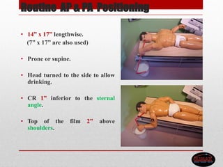 Routine AP & PA Positioning
• 14” x 17” lengthwise.
(7” x 17” are also used)
• Prone or supine.
• Head turned to the side to allow
drinking.
• CR 1” inferior to the sternal
angle.
• Top of the film 2” above
shoulders.
 