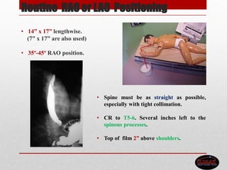 Routine RAO or LAO Positioning
• 14” x 17” lengthwise.
(7” x 17” are also used)
• 35º-45º RAO position.
• Spine must be as straight as possible,
especially with tight collimation.
• CR to T5-6. Several inches left to the
spinous processes.
• Top of film 2” above shoulders.
 