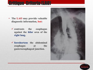 Critique Criteria (LAO)
• The LAO may provide valuable
diagnostic information, but:
 contrasts the esophagus
against the hilar area of the
right lung.
 foreshortens the abdominal
esophagus at the
gasteroesophageal junction.
 