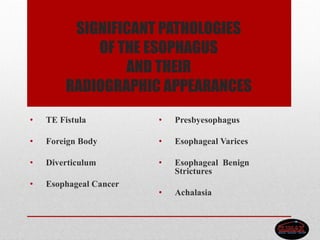 SIGNIFICANT PATHOLOGIES
OF THE ESOPHAGUS
AND THEIR
RADIOGRAPHIC APPEARANCES
• TE Fistula
• Foreign Body
• Diverticulum
• Esophageal Cancer
• Presbyesophagus
• Esophageal Varices
• Esophageal Benign
Strictures
• Achalasia
 