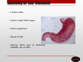 Anatomy of the Stomach
• Cardiac orifice
• Gastric (rugal) folds (rugae)
• Pylorus (sphincter)
• Zigzag (Z) line
• Superior (first) part of duodenum
(ampulla, cap, or bulb)
 