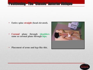 Positioning - The “Classic”Anterior Oblique
• Entire spine straight (head elevated).
• Coronal plane through shoulders
same as coronal plane through hips.
• Placement of arms and legs like this.
 