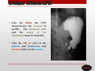Critique Criteria (LPO)
• Like the RAO, the LPO
demonstrates the stomach in
profile. The duodenal bulb
and the sweep of the
duodenum must be included.
• Like the AP, air rises to the
pylorus and duodenum, and
barium settles in the fundus.
 