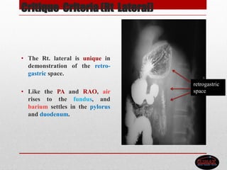 Critique Criteria (Rt Lateral)
• The Rt. lateral is unique in
demonstration of the retro-
gastric space.
• Like the PA and RAO, air
rises to the fundus, and
barium settles in the pylorus
and duodenum.
retrogastric
space
 