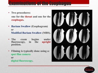 Examinations of the Esophagus
• Two procedures:
one for the throat and one for the
esophagus.
• Barium Swallow (Esophagram)
or
Modified Barium Swallow (MBS).
• The exam begins under
fluoroscopy, in the upright
position.
• Filming is typically done using a:
spot film camera
or
digital fluoroscopy.
 