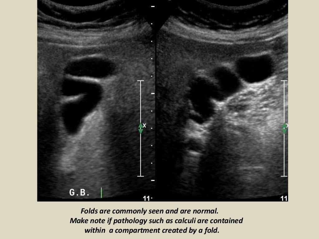 Presentation1, abdominal ultrasound anatomy.