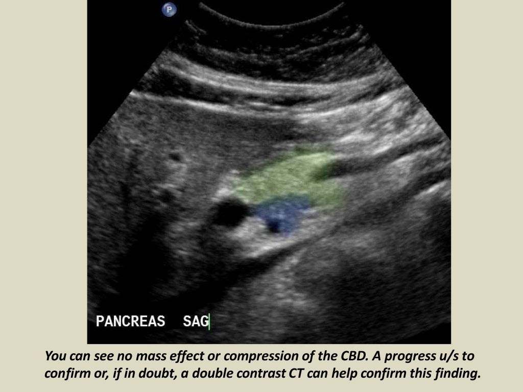 Presentation1, abdominal ultrasound anatomy.