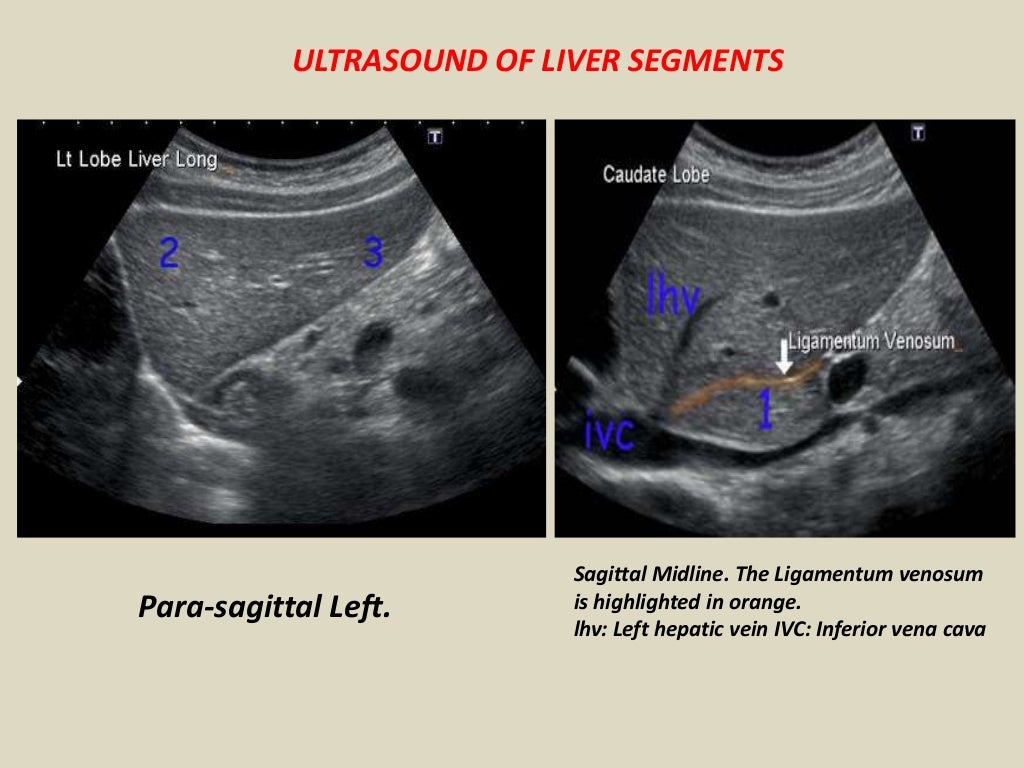 Presentation1, abdominal ultrasound anatomy.