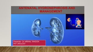 ANTENATAL HYDRONEPHROSIS AND
MANAGEMENT
Presenter- Dr. MRINAL TANDON
PDT UROLOGY
 