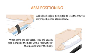 ARM POSITIONING
When arms are adducted, they are usually
held alongside the body with a “drawsheet”
that passes under the body.
Abduction should be limited to less than 90o to
minimize brachial plexus injury.
 