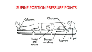 SUPINE POSITION PRESSURE POINTS
 