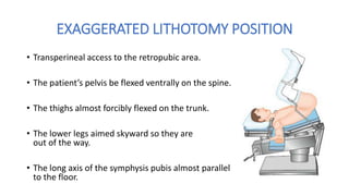 EXAGGERATED LITHOTOMY POSITION
• Transperineal access to the retropubic area.
• The patient’s pelvis be flexed ventrally on the spine.
• The thighs almost forcibly flexed on the trunk.
• The lower legs aimed skyward so they are
out of the way.
• The long axis of the symphysis pubis almost parallel
to the floor.
 