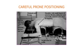 CAREFUL PRONE POSITIONING
 