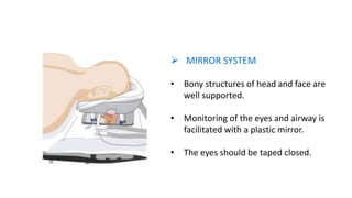  MIRROR SYSTEM
• Bony structures of head and face are
well supported.
• Monitoring of the eyes and airway is
facilitated with a plastic mirror.
• The eyes should be taped closed.
 