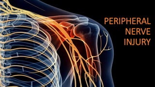 PERIPHERAL
NERVE
INJURY
 