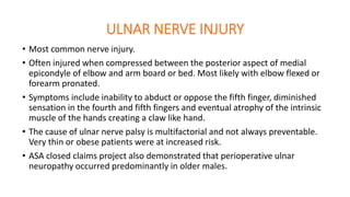 ULNAR NERVE INJURY
• Most common nerve injury.
• Often injured when compressed between the posterior aspect of medial
epicondyle of elbow and arm board or bed. Most likely with elbow flexed or
forearm pronated.
• Symptoms include inability to abduct or oppose the fifth finger, diminished
sensation in the fourth and fifth fingers and eventual atrophy of the intrinsic
muscle of the hands creating a claw like hand.
• The cause of ulnar nerve palsy is multifactorial and not always preventable.
Very thin or obese patients were at increased risk.
• ASA closed claims project also demonstrated that perioperative ulnar
neuropathy occurred predominantly in older males.
 