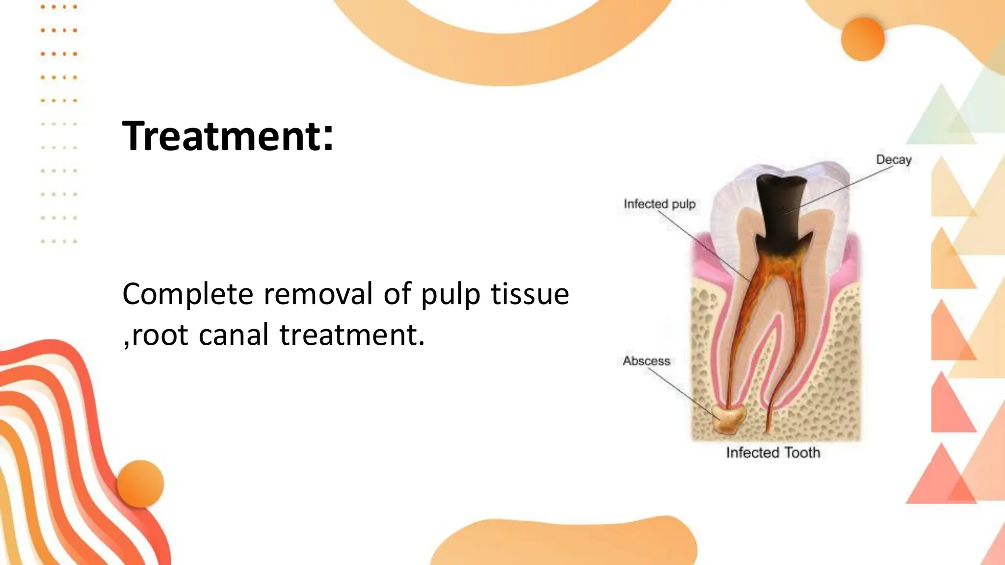 Treatment:
Complete removal of pulp tissue
,root canal treatment.
 