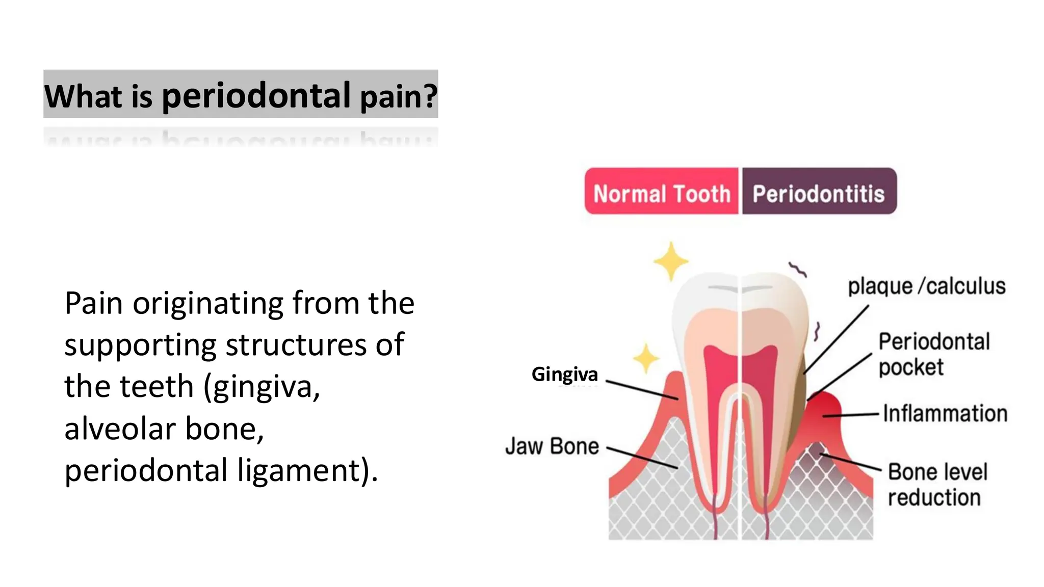 What is periodontal pain?
Pain originating from the
supporting structures of
the teeth (gingiva,
alveolar bone,
periodontal ligament).
Gingiva
 