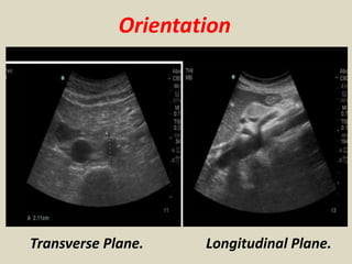 Orientation
Longitudinal Plane.Transverse Plane.
 