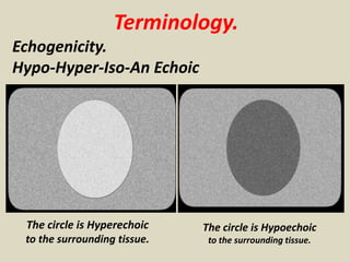 Terminology.
Echogenicity.
Hypo-Hyper-Iso-An Echoic
The circle is Hyperechoic
to the surrounding tissue.
The circle is Hypoechoic
to the surrounding tissue.
 