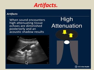 Presentation1, basic principle of ultrasound.