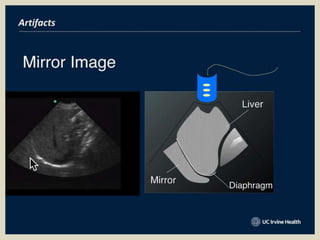 Presentation1, basic principle of ultrasound.