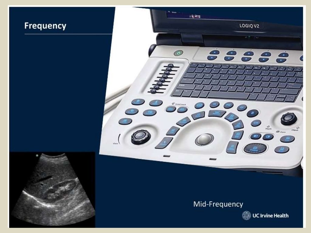 Presentation1, basic principle of ultrasound.