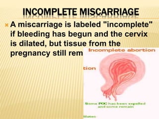 INCOMPLETE MISCARRIAGE
 A miscarriage is labeled "incomplete"
if bleeding has begun and the cervix
is dilated, but tissue from the
pregnancy still remains in the uterus.
 