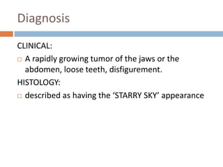 BURKITTS LYMPHOMA | PPTX