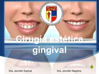 S
Cirugía estética
gingival
Dra. Jennifer Espinal Dra. Jennifer Negreira
 