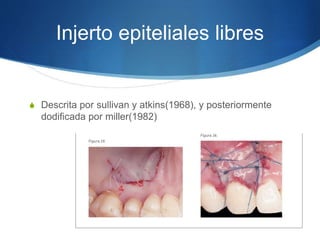 Injerto epiteliales libres
S Descrita por sullivan y atkins(1968), y posteriormente
dodificada por miller(1982)
 