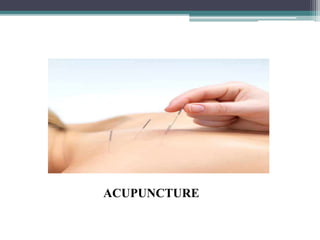 ACUPUNCTURE
 