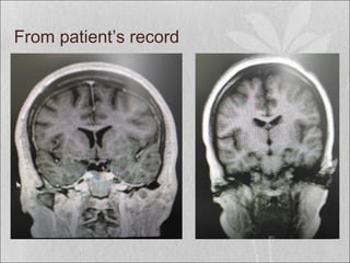 From patient’s record
 