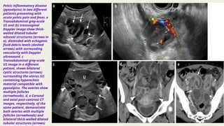 Comprehensive Gynecological Film Reading: Benign and Malignant ...