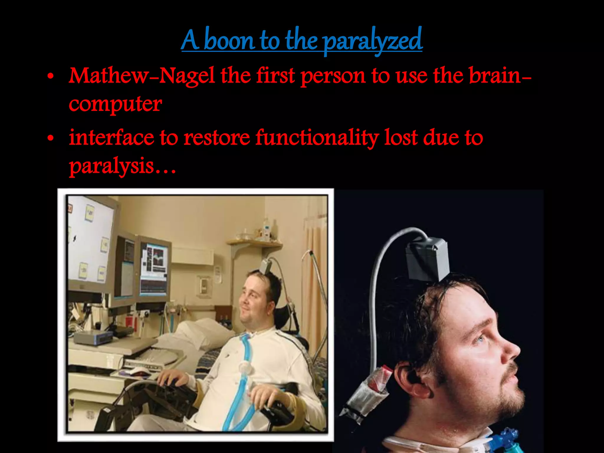 A boon to the paralyzed
• Mathew-Nagel the first person to use the brain-
computer
• interface to restore functionality lost due to
paralysis…
 