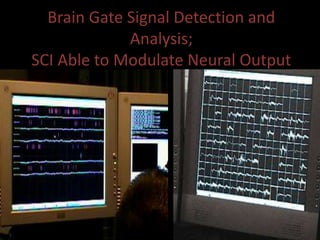 Brain Gate Signal Detection and
Analysis;
SCI Able to Modulate Neural Output
 