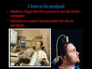 A boon to the paralyzed
• Mathew-Nagel the first person to use the brain-
computer
• interface to restore functionality lost due to
paralysis…
 