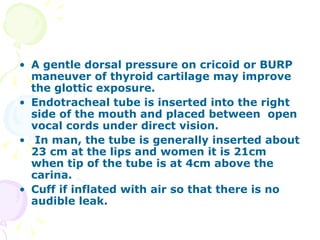 A gentle dorsal pressure on cricoid or BURP maneuver of thyroid cartilage may improve the glottic exposure. Endotracheal tube is inserted into the right side of the mouth and placed between  open vocal cords under direct vision. In man, the tube is generally inserted about 23 cm at the lips and women it is 21cm when tip of the tube is at 4cm above the carina. Cuff if inflated with air so that there is no audible leak. 