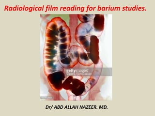 Radiological film reading for barium studies.
Dr/ ABD ALLAH NAZEER. MD.
 