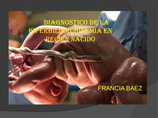        Diagnostico de la Hiperbilirrubinemia en     Recien Nacido FRANCIA BAEZ 