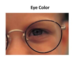 Eye Color
 