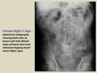 Presentation1, interpretation of x ray of the abdomen. | PPTX