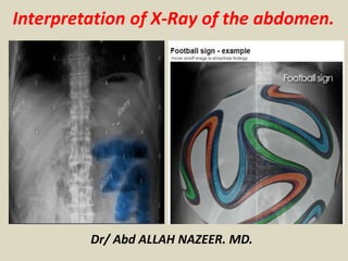 Dr/ Abd ALLAH NAZEER. MD.
Interpretation of X-Ray of the abdomen.
 
