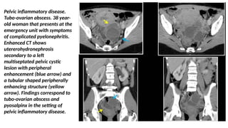 Comprehensive Diagnostic Imaging of Female Pelvic Diseases Using US ...