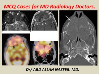 MCQ Cases for MD Radiology Doctors.
Dr/ ABD ALLAH NAZEER. MD.
 